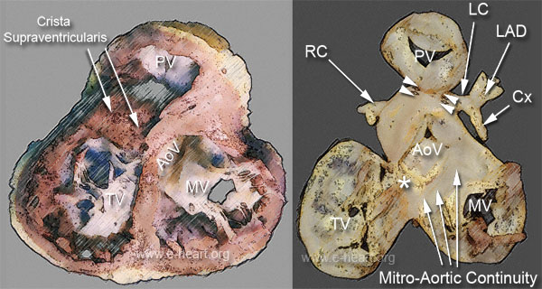 Fibrous Skeleton